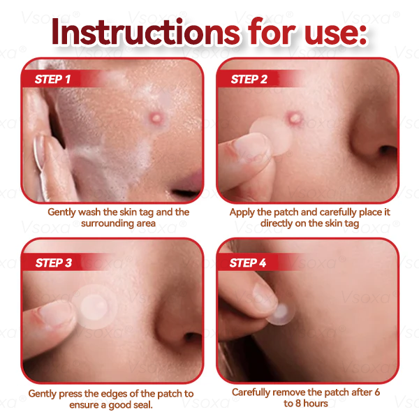 ๐๐ ๐๐ฅ๐ยฎ๐งMicroneedles Botanical Skin Tags Solution Patches - Made in the USA๐ฉโโ๏ธ