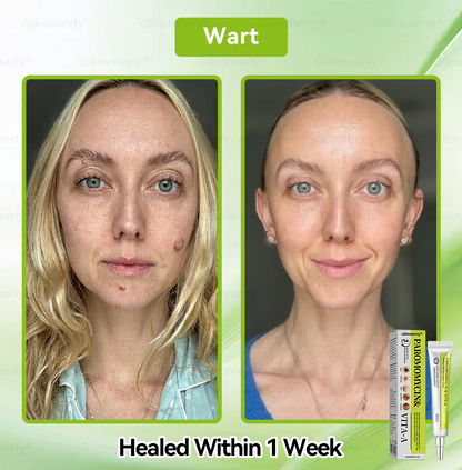 𝐺𝑙𝑖𝑚𝑚𝑒𝑟𝑙𝑦® 👩‍⚕️𝑃𝑎𝑟𝑜𝑚𝑜𝑚𝑦𝑐𝑖𝑛 & 𝑉𝑖𝑡𝑎-𝑎 𝑅𝑒𝑡𝑖𝑛𝑜𝑙 𝑆ℎ𝑜𝑡 𝑆𝑘𝑖𝑛 𝑅𝑒𝑝𝑎𝑖𝑟 𝐶𝑟𝑒𝑎𝑚（𝐖𝐢𝐭𝐡 𝐋𝐢𝐪𝐮𝐢𝐝 𝐌𝐢𝐜𝐫𝐨𝐧𝐞𝐞𝐝𝐥𝐞𝐬, 𝐆𝐞𝐧𝐭𝐥𝐲 𝐆𝐞𝐭𝐬 𝐑𝐢𝐝 𝐎𝐟 𝐖𝐚𝐫𝐭𝐬, 𝐌𝐨𝐥𝐞𝐬, 𝐀𝐠𝐞 𝐒𝐩𝐨𝐭𝐬, 𝐀𝐧𝐝 𝐒𝐤𝐢𝐧 𝐓𝐚𝐠𝐬 ）🪄