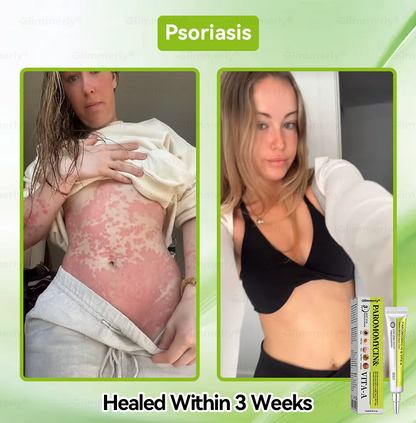 𝐺𝑙𝑖𝑚𝑚𝑒𝑟𝑙𝑦® 👩‍⚕️𝑃𝑎𝑟𝑜𝑚𝑜𝑚𝑦𝑐𝑖𝑛 & 𝑉𝑖𝑡𝑎-𝑎 𝑅𝑒𝑡𝑖𝑛𝑜𝑙 𝑆ℎ𝑜𝑡 𝑆𝑘𝑖𝑛 𝑅𝑒𝑝𝑎𝑖𝑟 𝐶𝑟𝑒𝑎𝑚（𝐖𝐢𝐭𝐡 𝐋𝐢𝐪𝐮𝐢𝐝 𝐌𝐢𝐜𝐫𝐨𝐧𝐞𝐞𝐝𝐥𝐞𝐬, 𝐆𝐞𝐧𝐭𝐥𝐲 𝐆𝐞𝐭𝐬 𝐑𝐢𝐝 𝐎𝐟 𝐖𝐚𝐫𝐭𝐬, 𝐌𝐨𝐥𝐞𝐬, 𝐀𝐠𝐞 𝐒𝐩𝐨𝐭𝐬, 𝐀𝐧𝐝 𝐒𝐤𝐢𝐧 𝐓𝐚𝐠𝐬 ）🪄