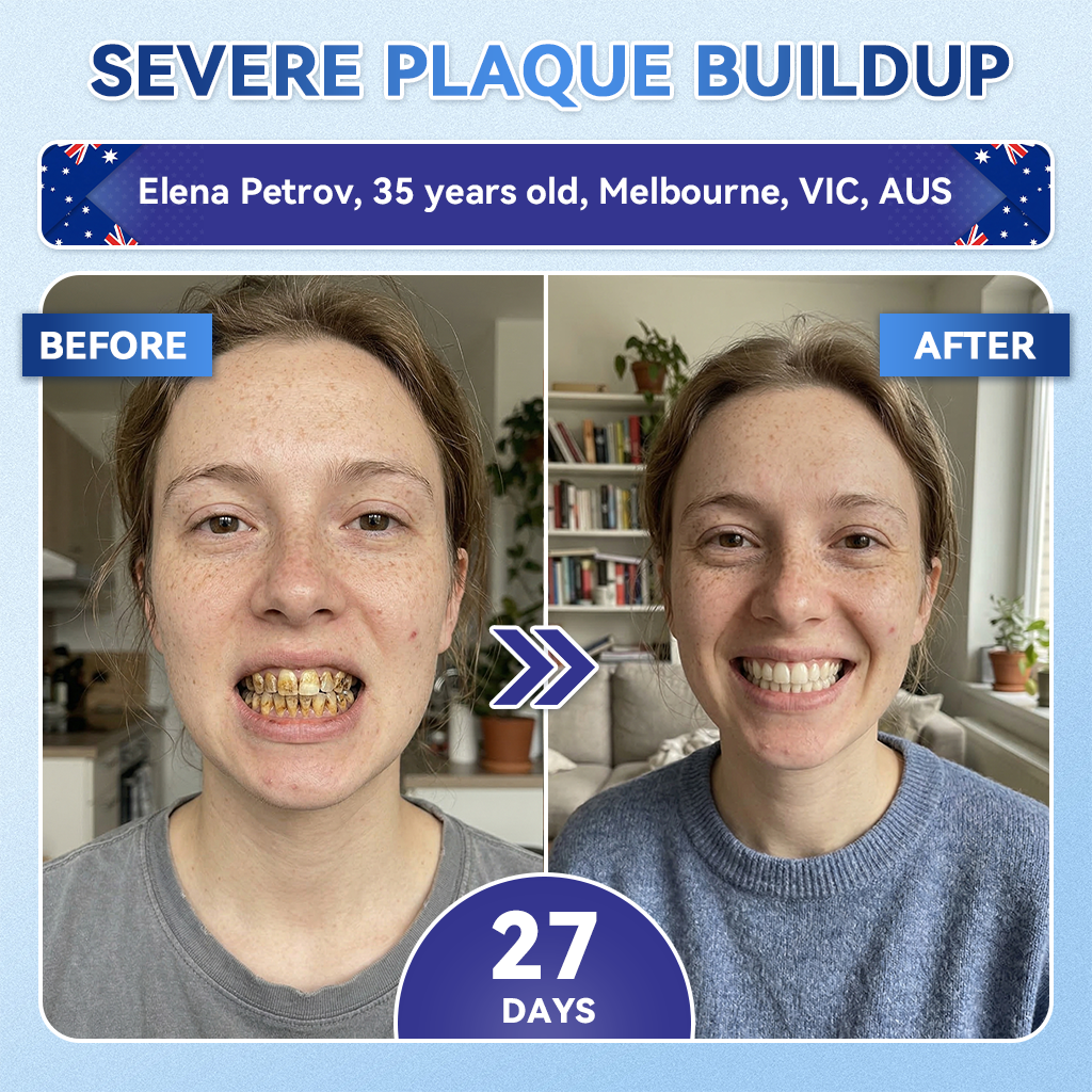 𝑮𝒍𝒊𝒎𝒎𝒆𝒓𝒍𝒚® 🦷 Tideglusib Fast‑Dissolving Tooth & Gum Repair Oral Strips🎋(Supports tooth repair and helps relieve gum discomfort and other common oral concerns)