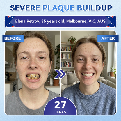 𝑮𝒍𝒊𝒎𝒎𝒆𝒓𝒍𝒚® 🦷 Tideglusib Fast‑Dissolving Tooth & Gum Repair Oral Strips🎋(Supports tooth repair and helps relieve gum discomfort and other common oral concerns)