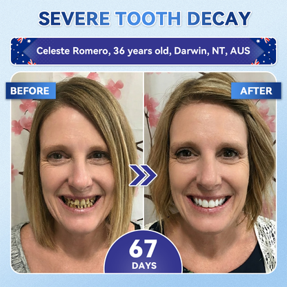 𝑮𝒍𝒊𝒎𝒎𝒆𝒓𝒍𝒚® 🦷 Tideglusib Fast‑Dissolving Tooth & Gum Repair Oral Strips🎋(Supports tooth repair and helps relieve gum discomfort and other common oral concerns)