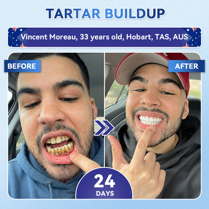 𝑮𝒍𝒊𝒎𝒎𝒆𝒓𝒍𝒚® 🦷 Tideglusib Fast‑Dissolving Tooth & Gum Repair Oral Strips🎋(Supports tooth repair and helps relieve gum discomfort and other common oral concerns)