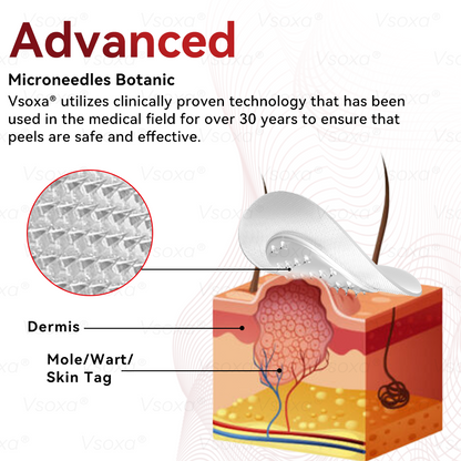 𝑉𝑠𝑜𝑥𝑎®💧Microneedles Botanical Skin Tags Solution Patches - Made in the USA👩‍⚕️