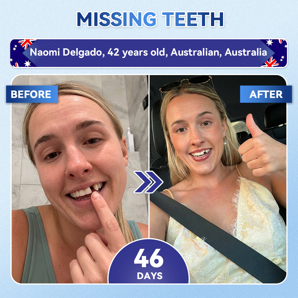 𝑮𝒍𝒊𝒎𝒎𝒆𝒓𝒍𝒚® 🦷 Tideglusib Fast‑Dissolving Tooth & Gum Repair Oral Strips🎋(Supports tooth repair and helps relieve gum discomfort and other common oral concerns)